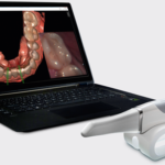 Преносим CS 3600 3D Scanner – бързо и гъвкаво интраорално сканиране