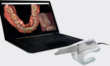 Преносим CS 3600 3D Scanner – бързо и гъвкаво интраорално сканиране