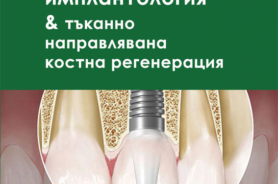 Представяме ви книгата “Дентална имплантология & тъканно направлявана костна регенерация” – второ издание