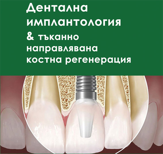 Представяме ви книгата “Дентална имплантология & тъканно направлявана костна регенерация” – второ издание
