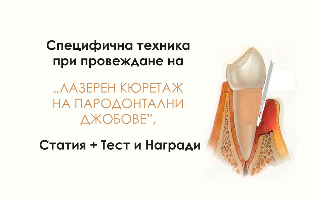 Специфична техника при провеждане на „Лазерен кюретаж на пародонтални джобове”, Статия + Тест с награди