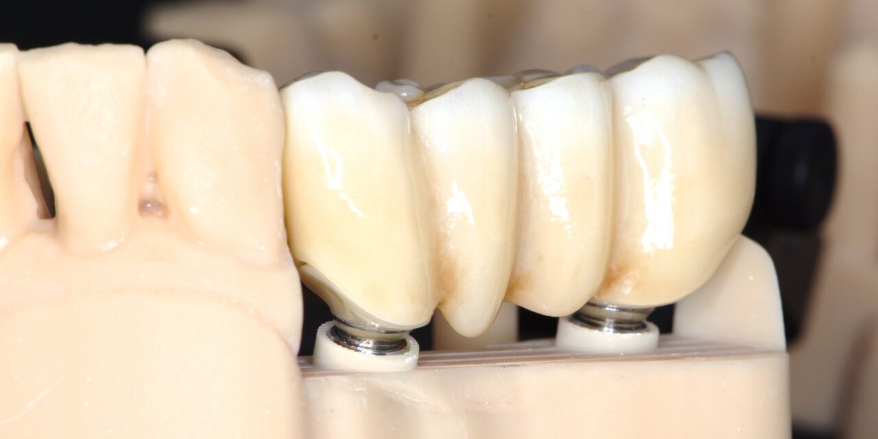 Семинар: Специфични протетични решения върху импланти – без митове и отвъд догмите, 30 септември 2023 г.