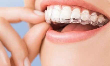 Представяме нашите безцветни алайнери – Clear Smile от Infinity Dental Lab Bulgaria + Видео