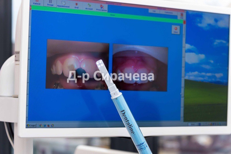 Дентална апаратура в ENDODENT