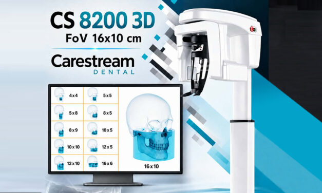 CARESTREAM CS 8200 3D – 2D И 3D ОБРАЗНА ДИАГНОСТИКА ЗА СЪВРЕМЕННАТА ДЕНТАЛНА ПРАКТИКА, FOV ДО 16 × 10 CM